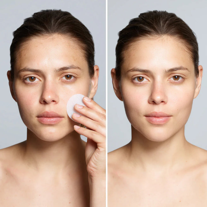 Even Skin Beta Hydroxy Pad